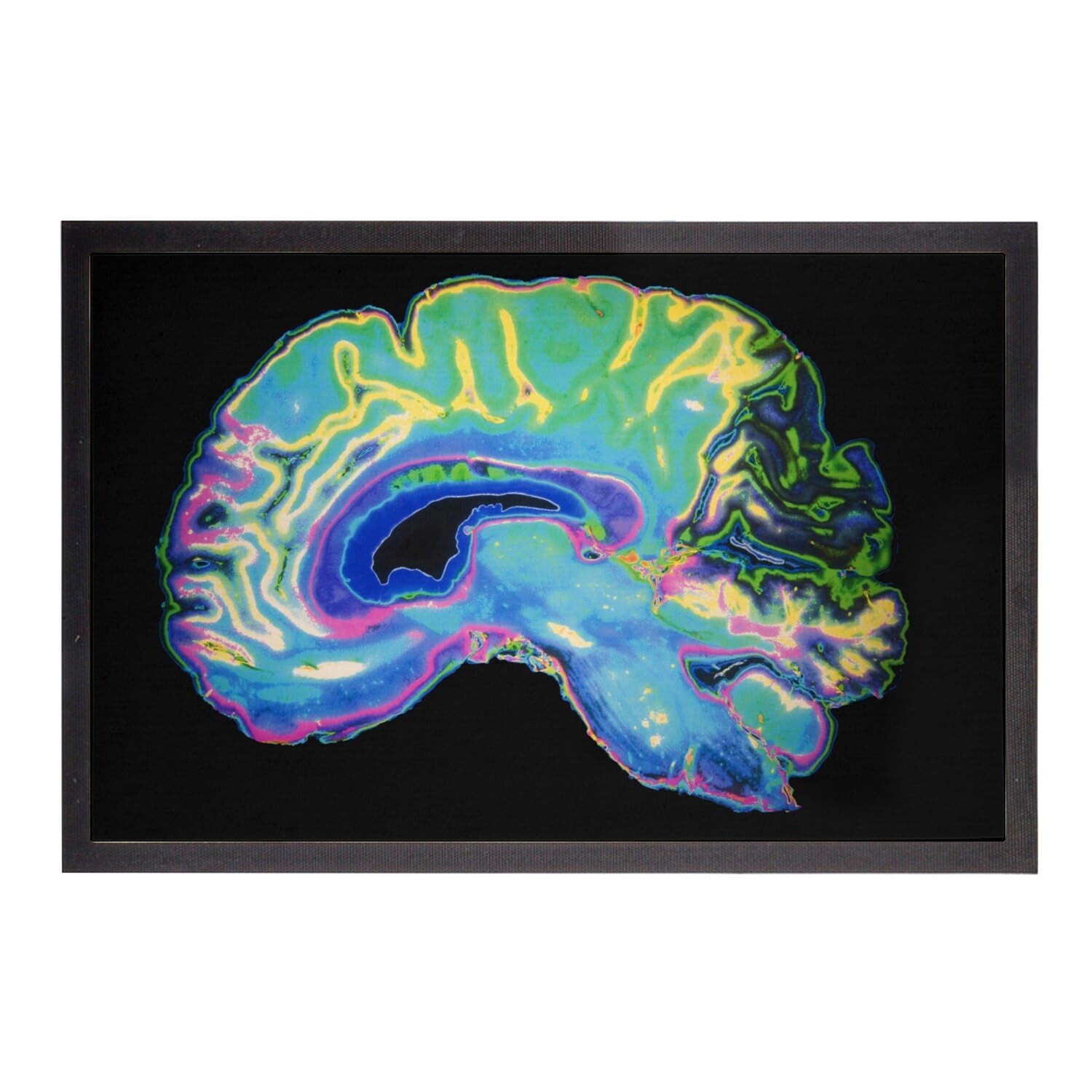 Paillasson scanner cerveau radiographie 60x40cm pour entrée originale