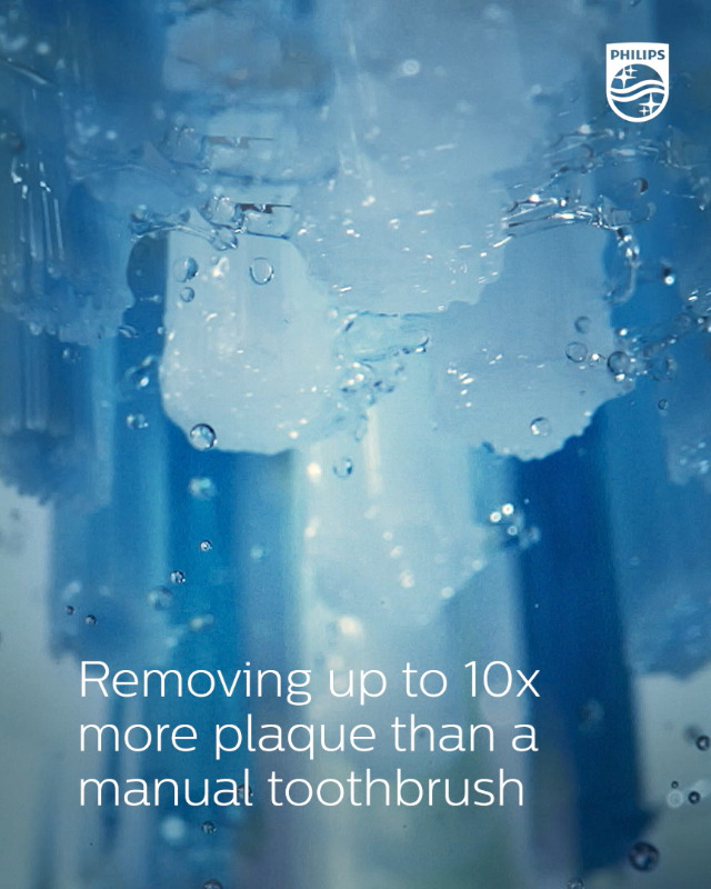 Amazon.com: Philips Sonicare 9000 Special Edition Rechargeable