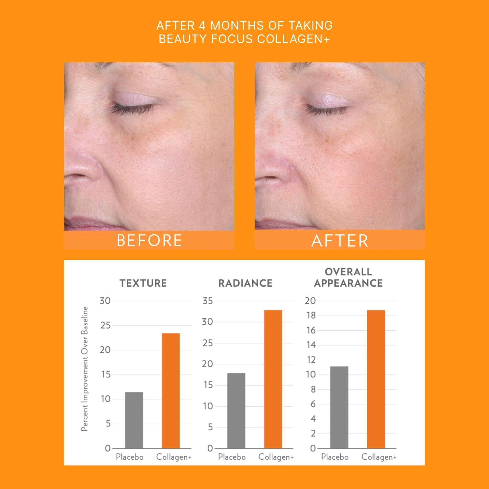Amazon.com: Nu Skin Beauty Focus Collagen+ | Marine Collagen