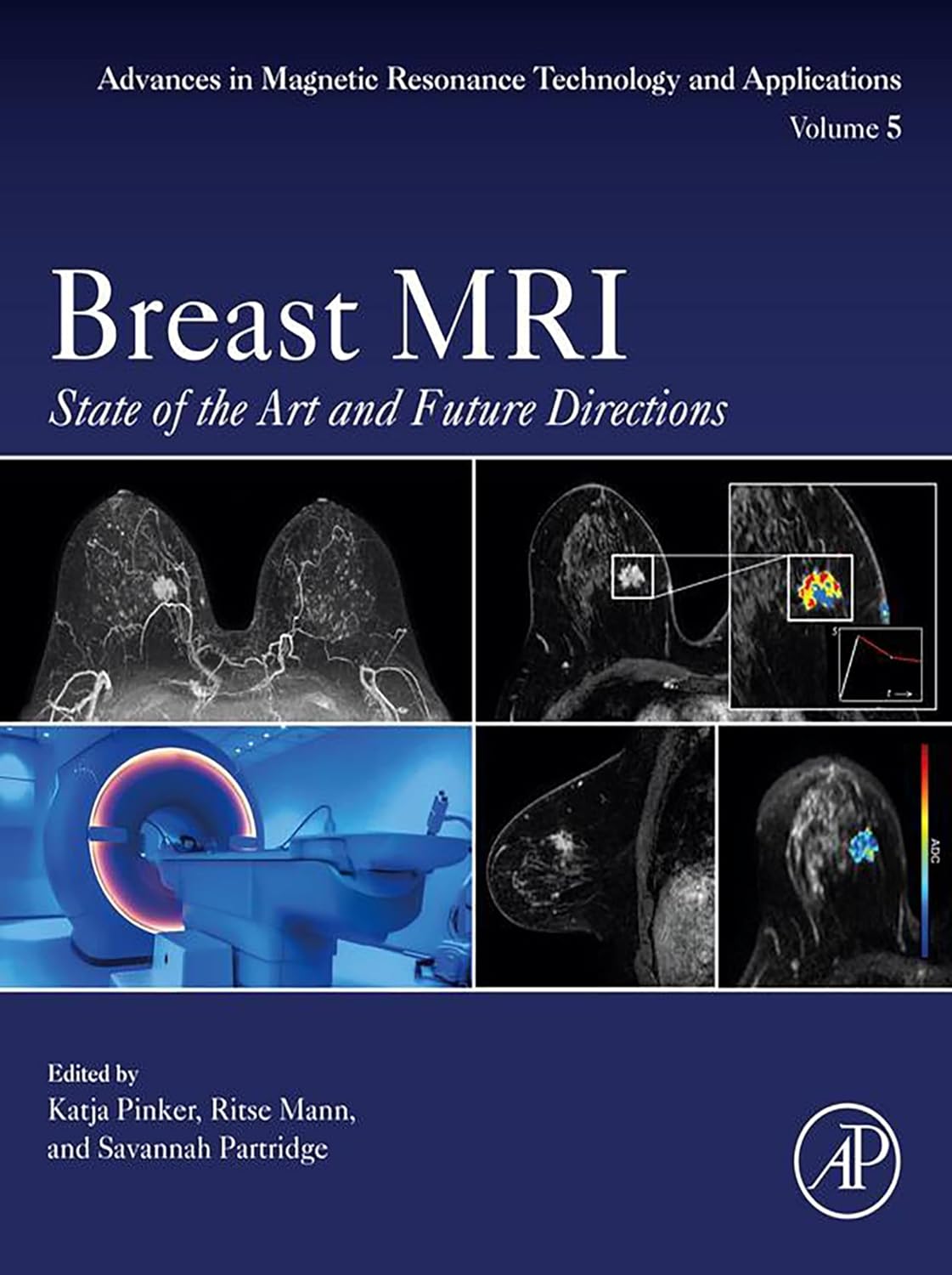 Breast MRI: State of the Art and Future Directions (Advances in Magnetic Resonance Technology and Applications)