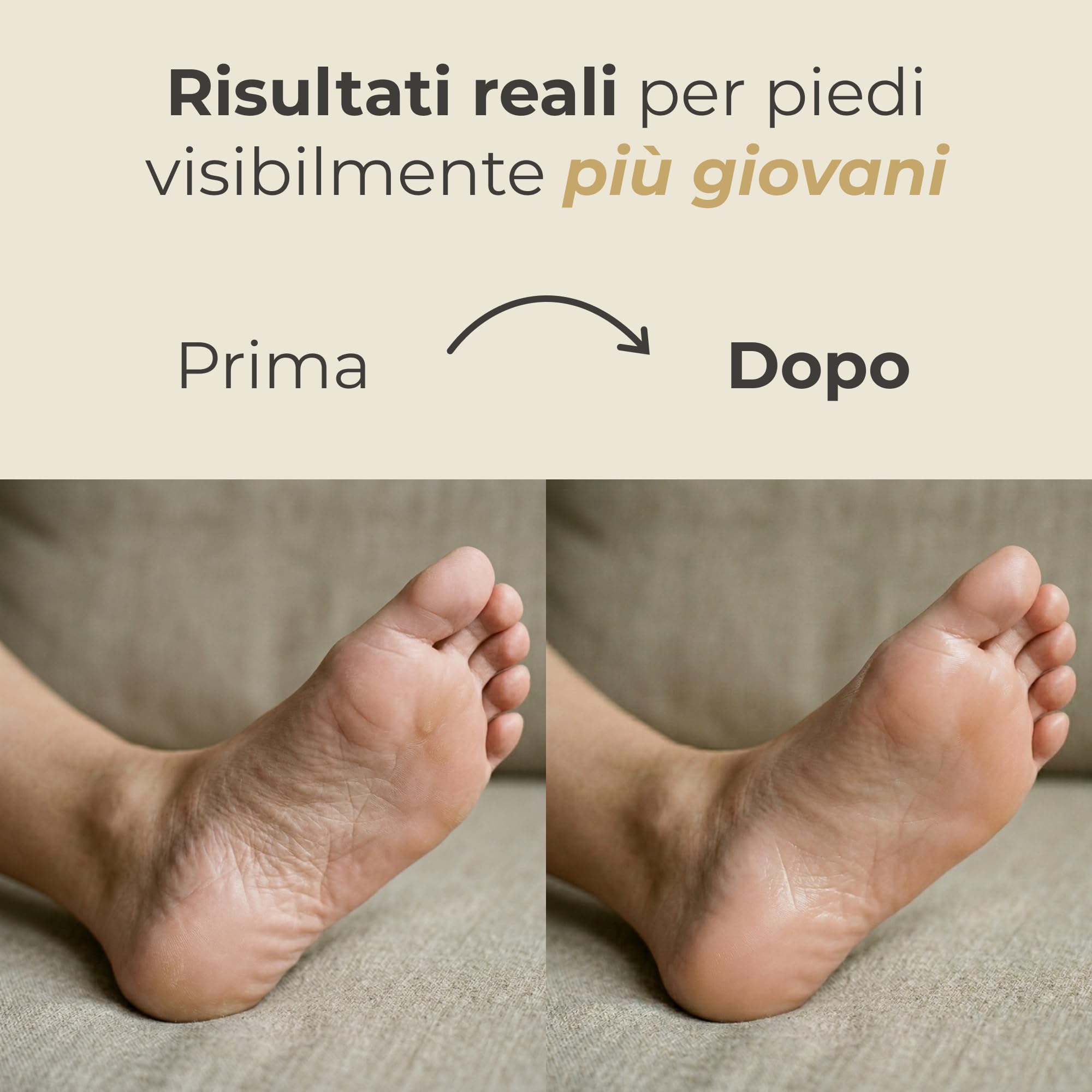 NYV Mask Nutriente Trattamento Intensivo Piedi - Maschera in Calzari Monouso con Aloe, Bava di Lumaca, Urea, Acido Ialuronico e Allantoina - Home SPA - 2 Paia