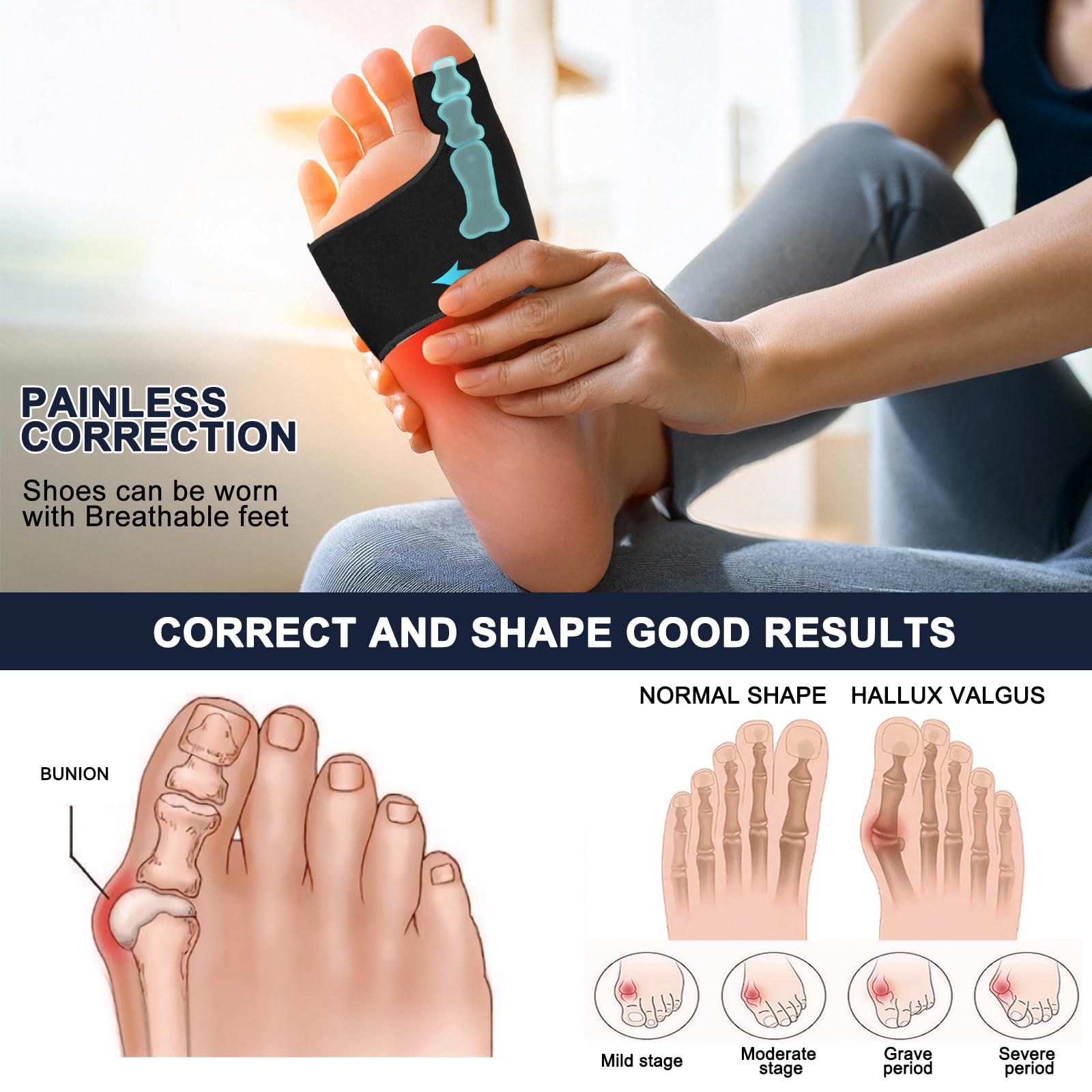 tongtonglovely 2 Pcs Bunion Corrector Relief Sleeve, Big Toe Straightener with Splint & Pads, Hallux Valgus Relief, Orthopedic Brace Big Toe Alignment (black)