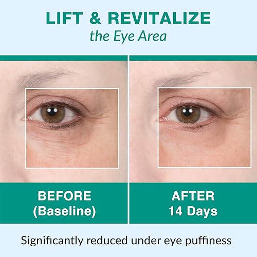 Miniatura 6 de Ventosas de masaje facial y anticelulítico para uso profesional y en casa set de ventosaterapia con libro sobre el tema PDF de Lure