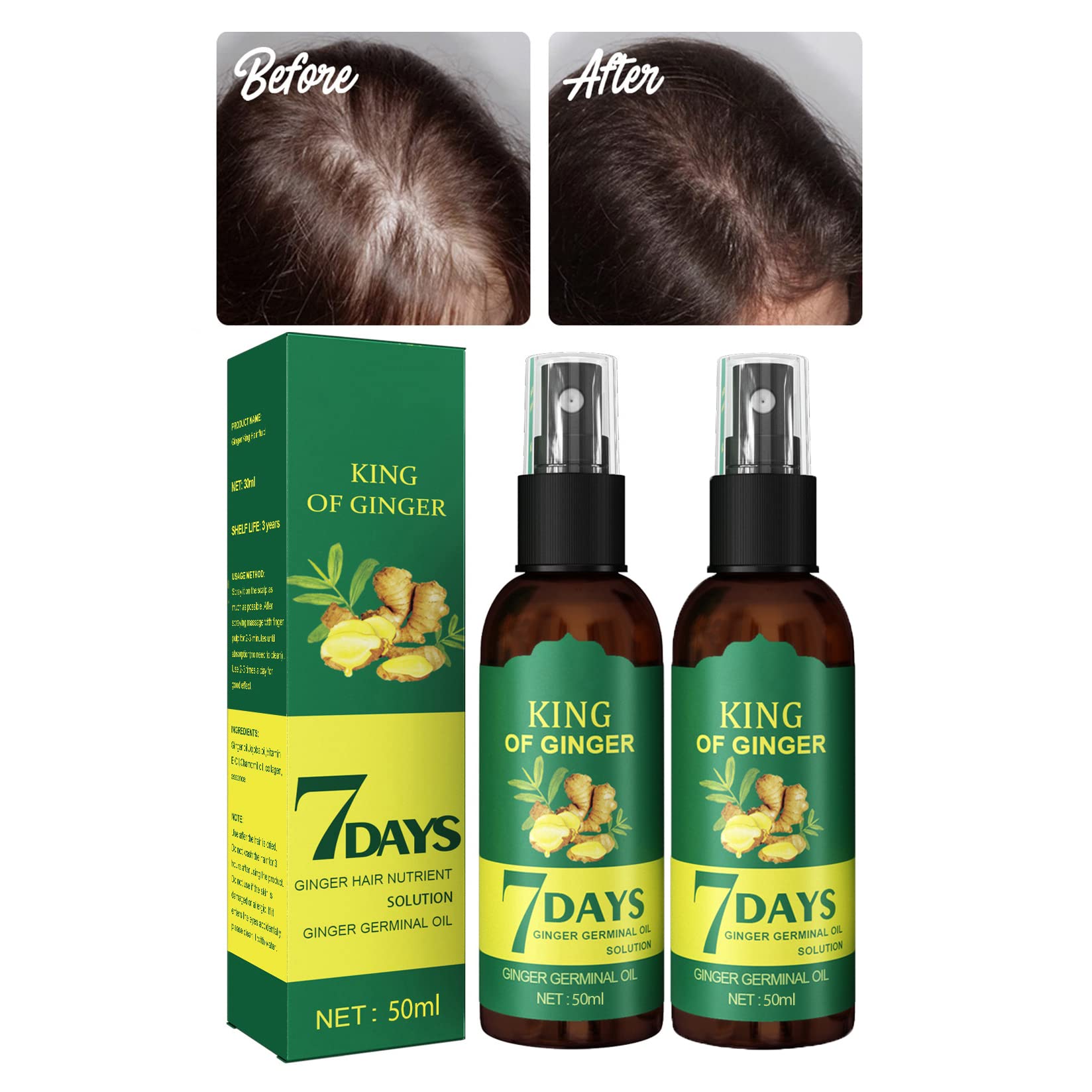 DIYIER Shouga Kingu Hair Growth Oil, King of Ginger 7 Days Hair Growth, Shougagro Japanese Hair Growth Spray, Ginger Oil for Hair Growth, Anti-Hair Loss Oil (2Pcs)
