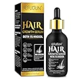 5% Minoxidil Hair Growth Serum,Minoxidil For Men and Women Hair,2.02 oz Biotin Hair Regrowth Serum Treatment For Getting Thicker Healthier Hair