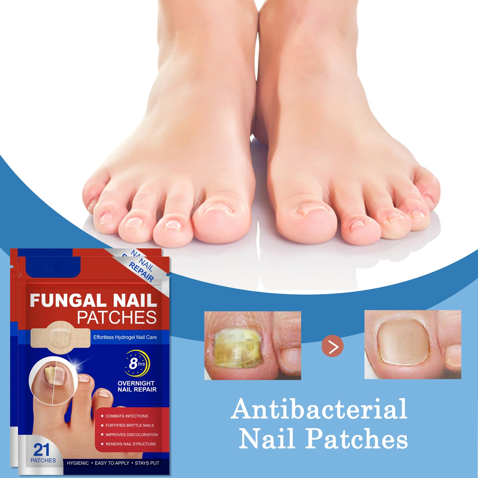 Fungal Nail Hydrogel Patches, Overnight for Toenail Fungus Fortifies Brittle Nails, Improves Discoloration & Renews Structure - Image 2