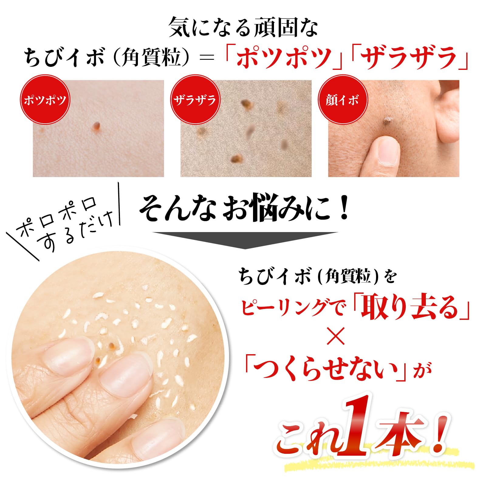 Amazon.co.jp: 薬用 イボ取り ピーリング 自宅で簡単 累計35万本 首 顔