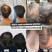 Vista 8 de IMPERIO Fibras de construcción del cabello para adelgazar el cabello, 0.86 onzas de fibras de pelo de alta calidad para mujeres y hombres en calidad