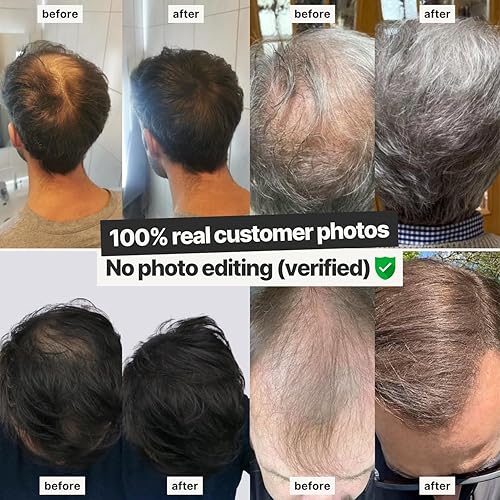 Miniatura 8 de IMPERIO Fibras de construcción del cabello para adelgazar el cabello, 0.92 oz de fibras capilares de alta calidad para mujeres y hombres en calidad