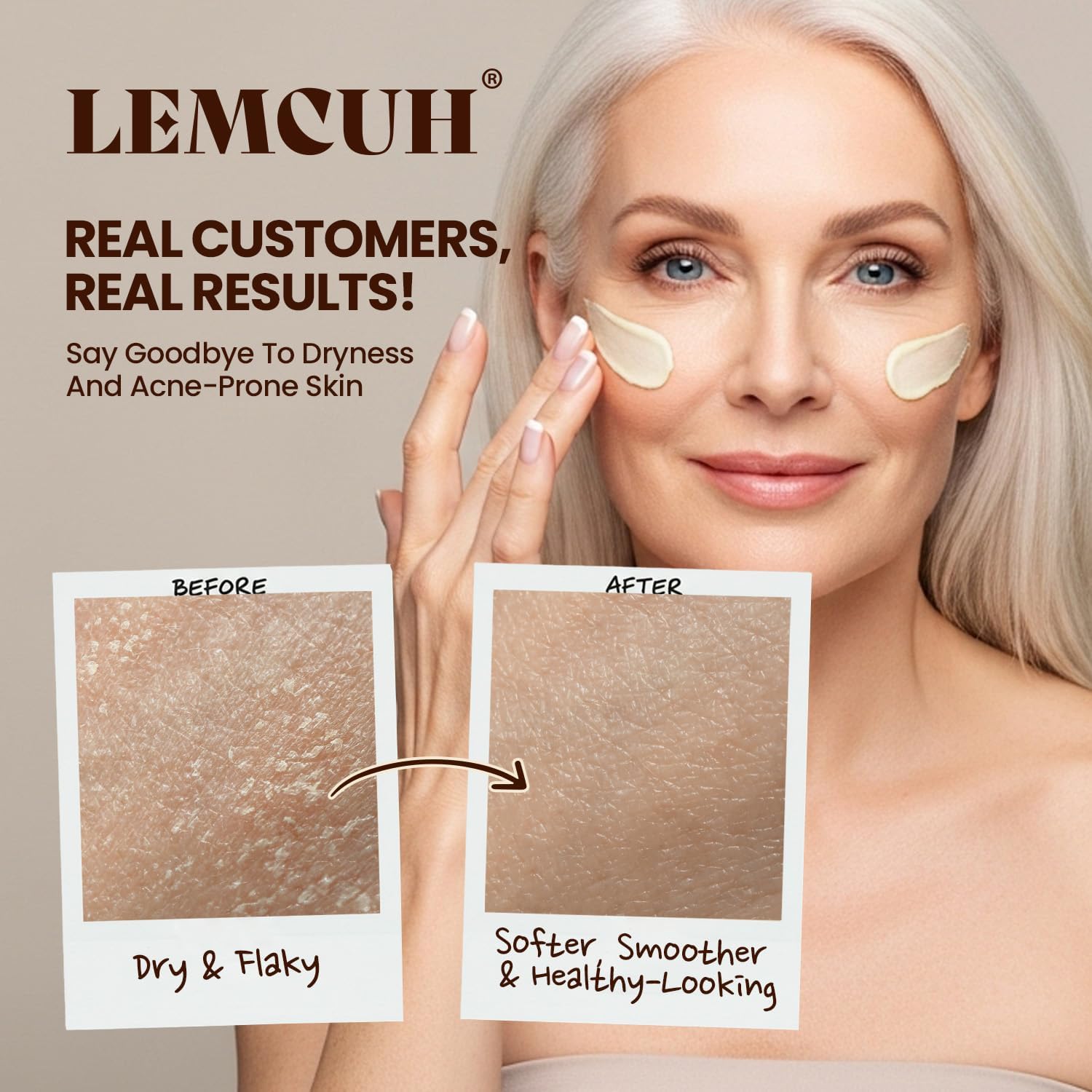 Beef Tallow Skincare Moisturizer for face: 100% Grass Fed Whipped Beef Tallow Face Cream With Organic Raw Honey, Jojoba Oil, Vitamin E - Moisturizer for Face Body for Mature - Dry Eczema or Sensitive Skin Women Men (120 G) - Image 2