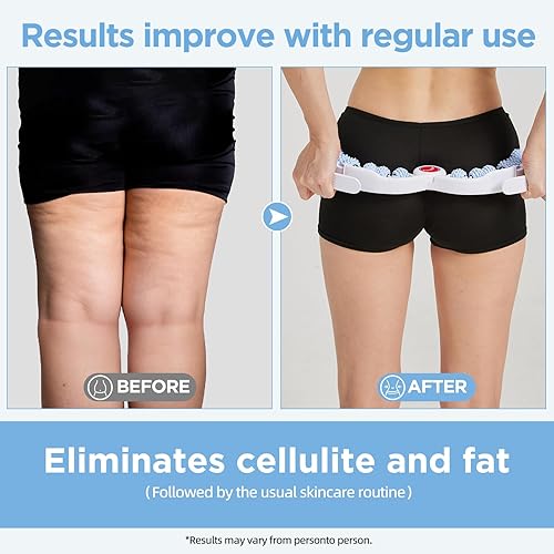 Miniatura 4 de Herramienta de masaje para celulitis, masajeador de drenaje linfático, rodillo muscular, masaje de fascia profunda, eliminación de piel con