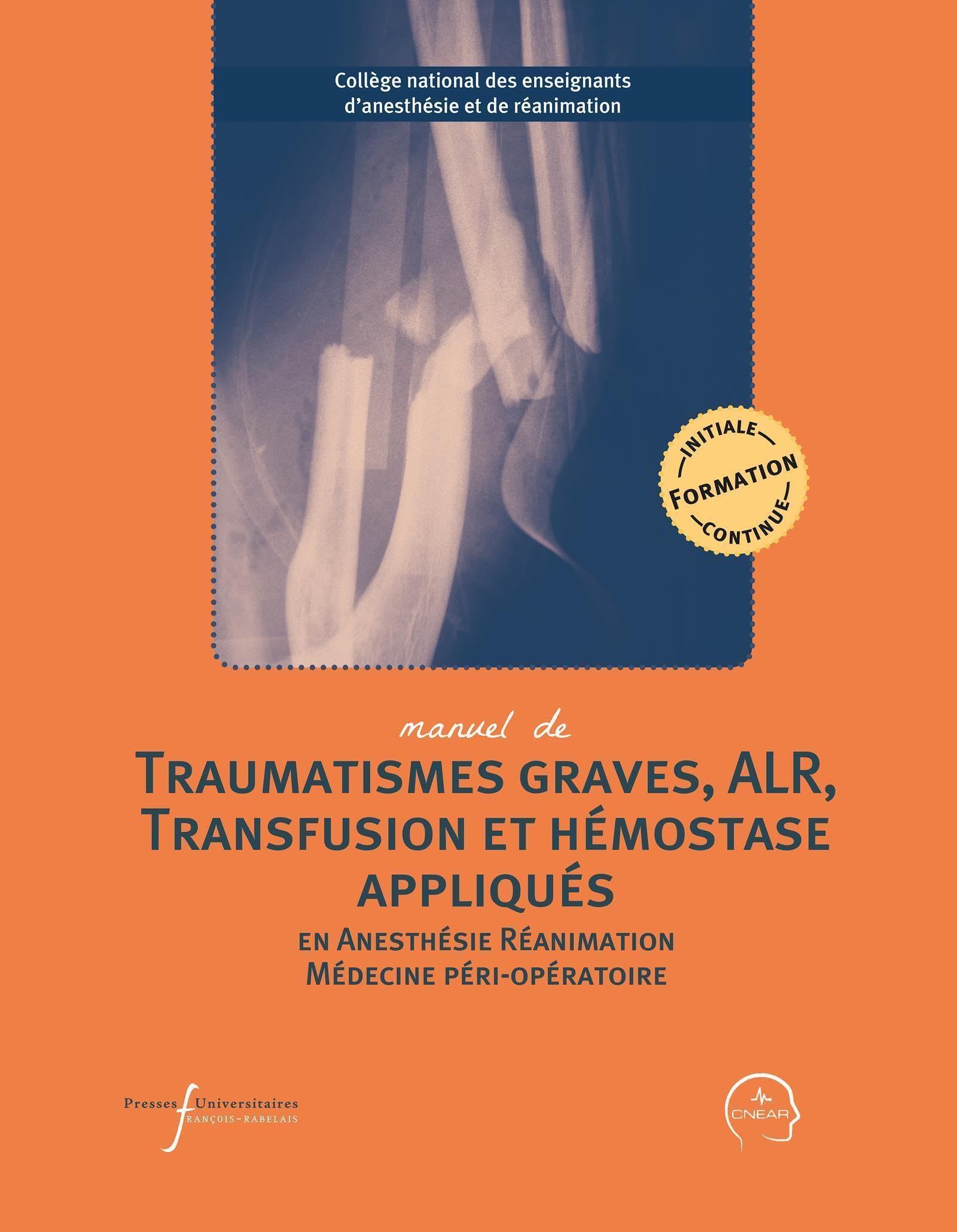 Manuel de traumatismes graves, ALR, transfusion et hémostase appliqués: En anesthésie-réanimation et médecine péri-opératoire