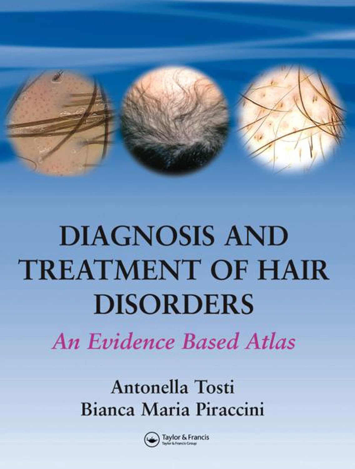 Diagnosis and Treatment of Hair Disorders: An Evidence-Based Atlas