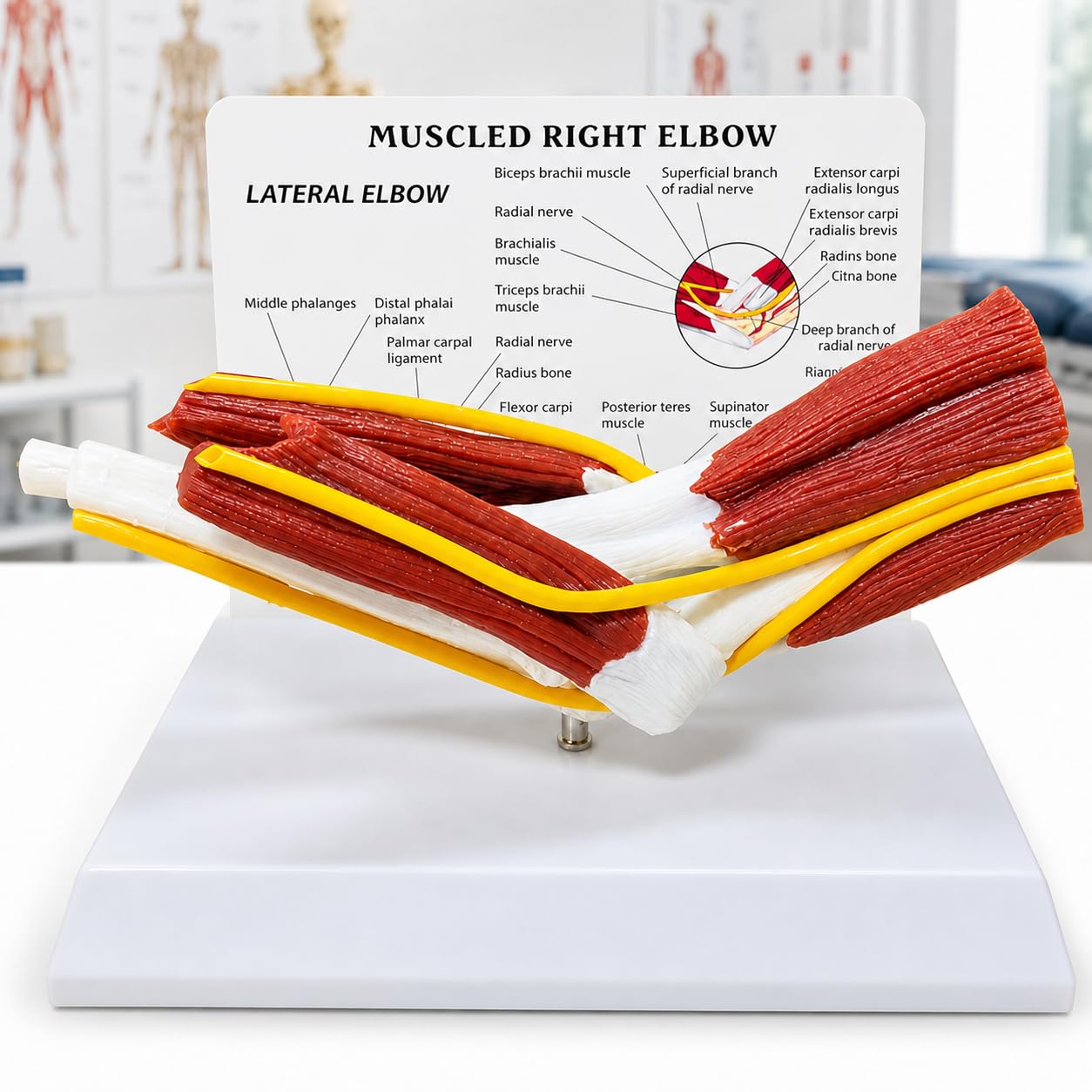 TsoLay Human Elbow Joint Anatomy Model, Elbow Joint Muscle Model Teaching Tool PVC for Veterinary Study