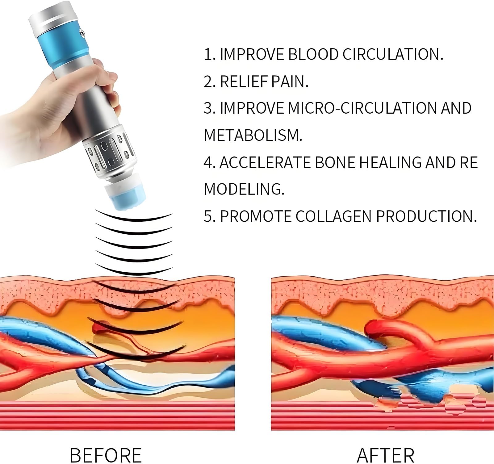 Generic Macchina extracorporea di terapia di Wave di urto per uso medico