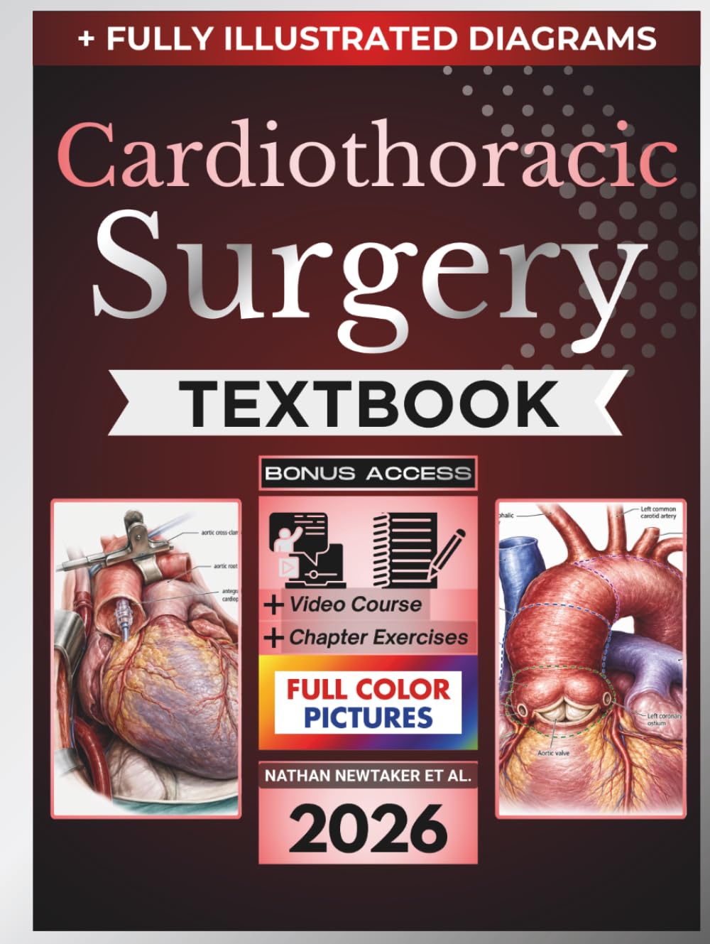 CARDIOTHORACIC SURGERY TEXTBOOK: Fully Illustrated Clinical Guide to Diagnostic Reasoning, Operative Decision-Making and Comprehensive Cardiac, Thoracic, Aortic Esophageal and Critical Care Surgery