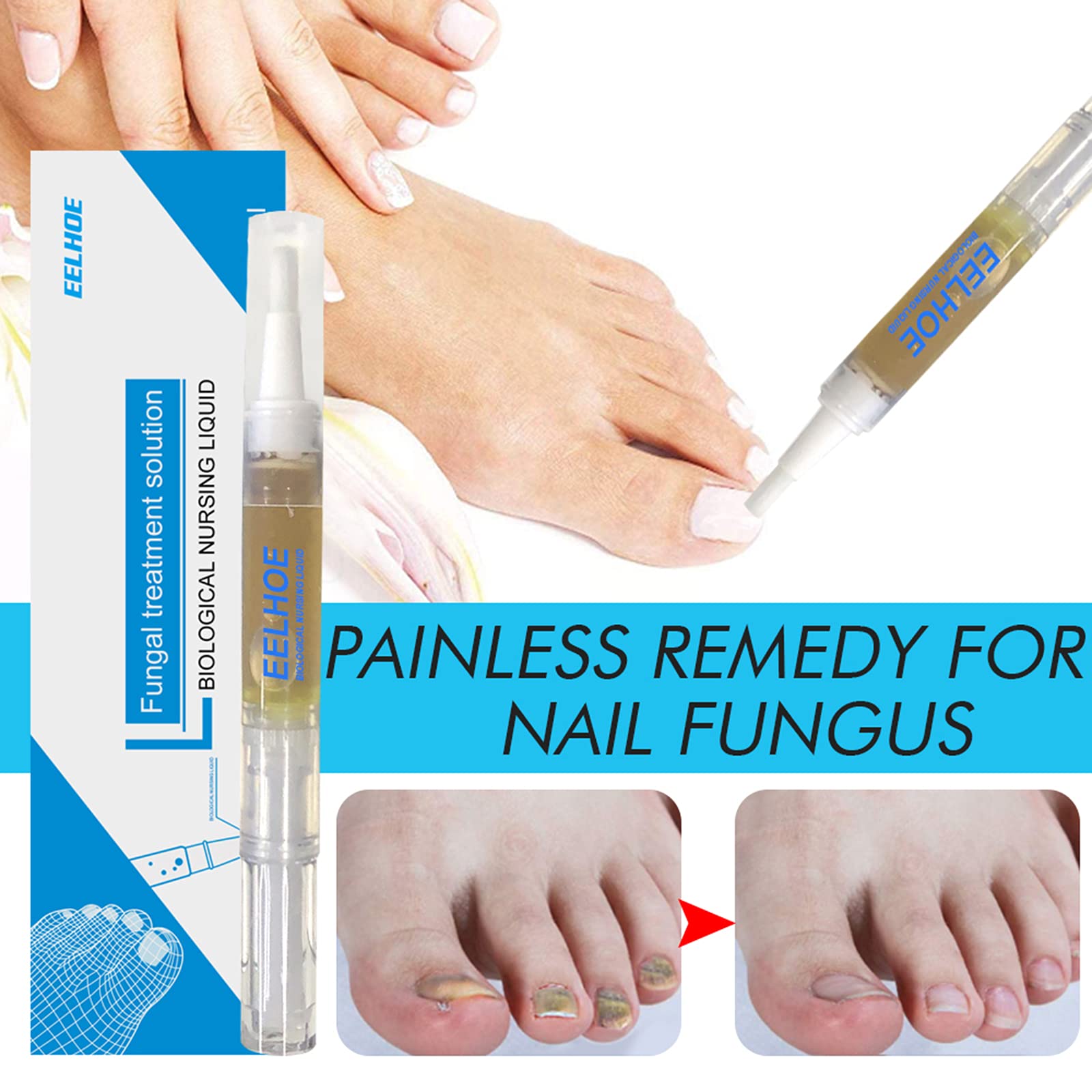 Buy 3Pcs 3ML Fungal Nail Treatment Pen Onychomycosis Paronychia Anti