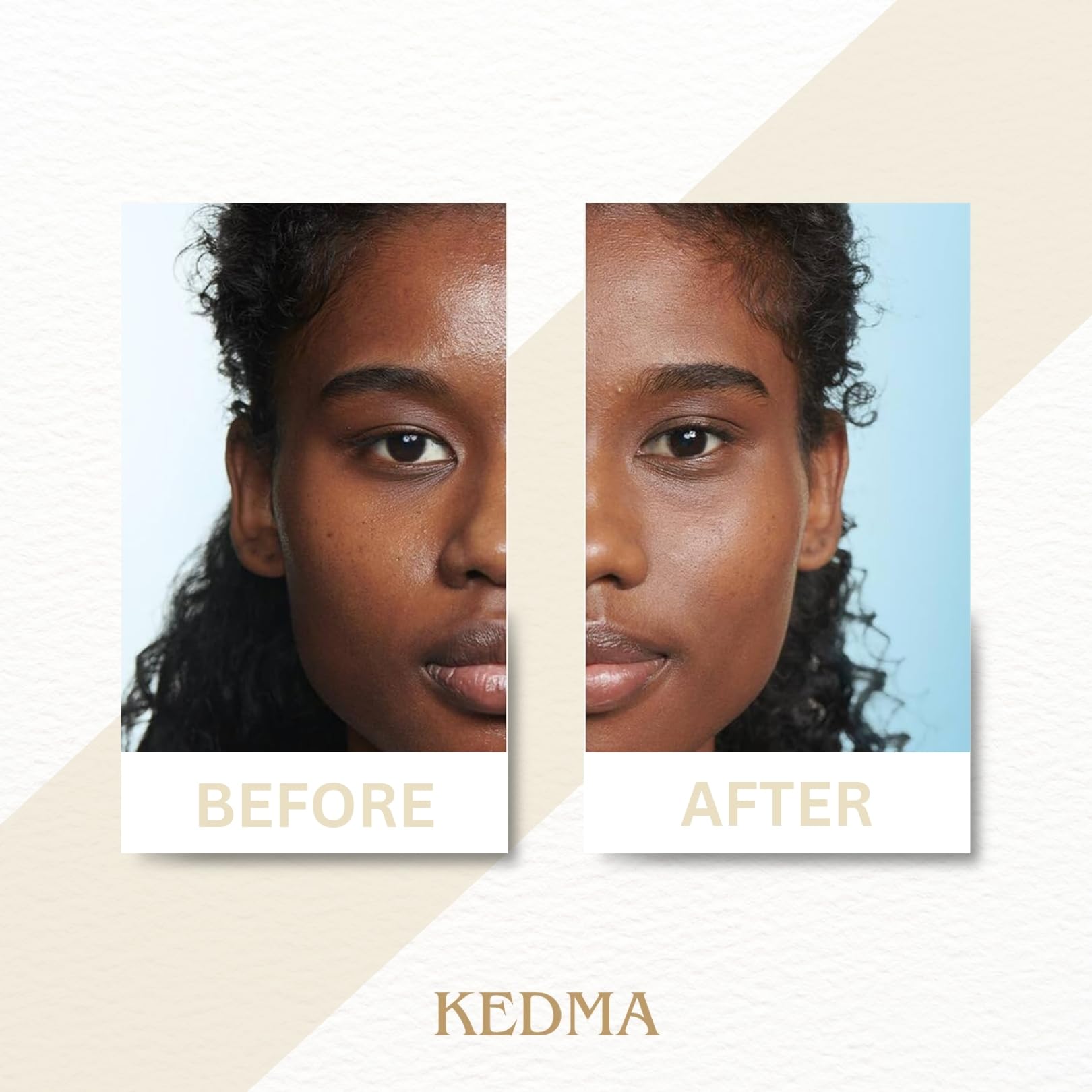 KEDMA - Masque Exfoliant Visage - Peau Douce & Éclatante - 100g | Le masque exfoliant élimine les cellules mortes et les impuretés pour une peau plus lisse, douce et lumineuse.