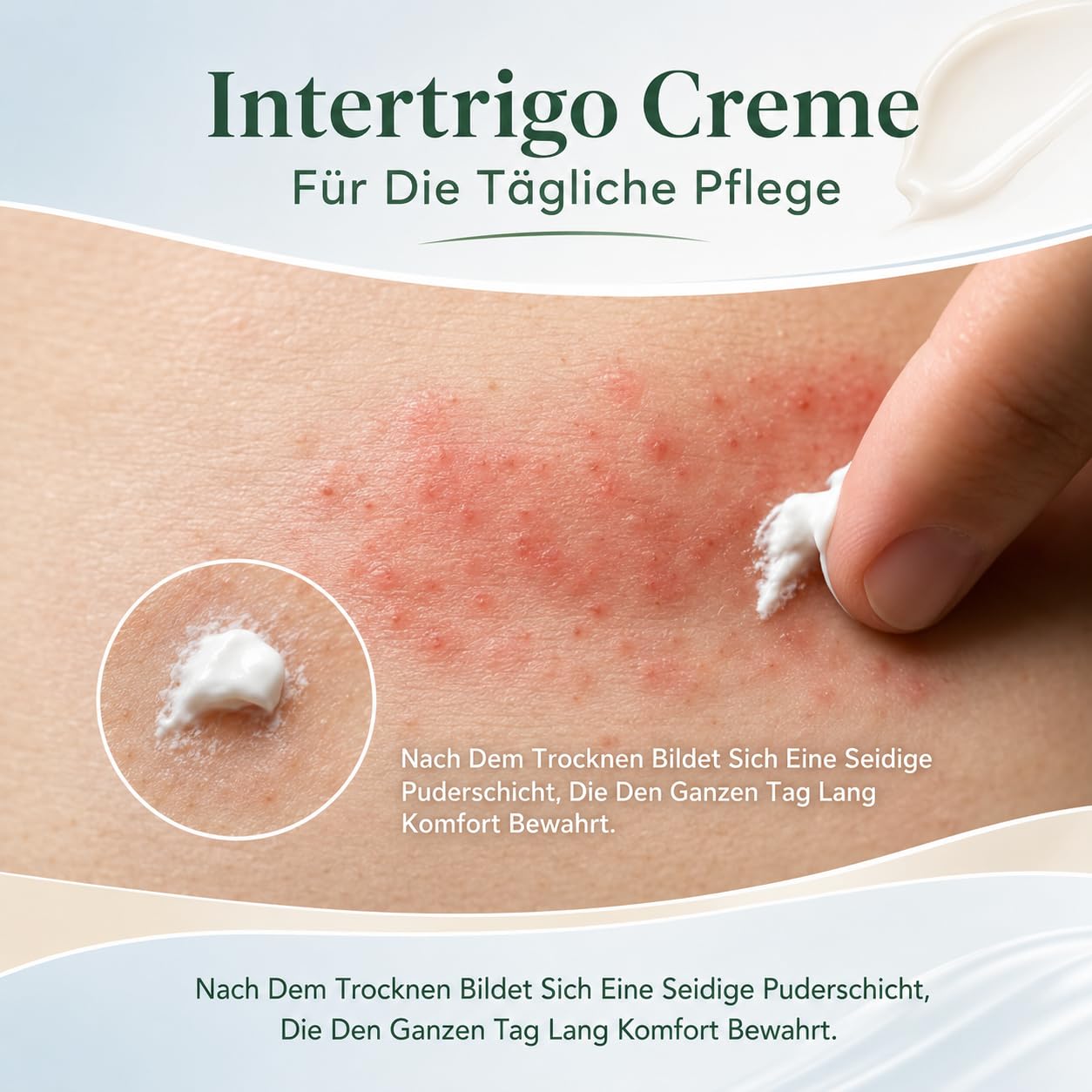 Healora Intertrigo Relief Cream Hautpflege Creme Für Gereizte Haut Sanfte Pflege Für Reibungsempfindliche Hautbereiche Unter Brust Achseln Und Körperfalten (1 pcs)