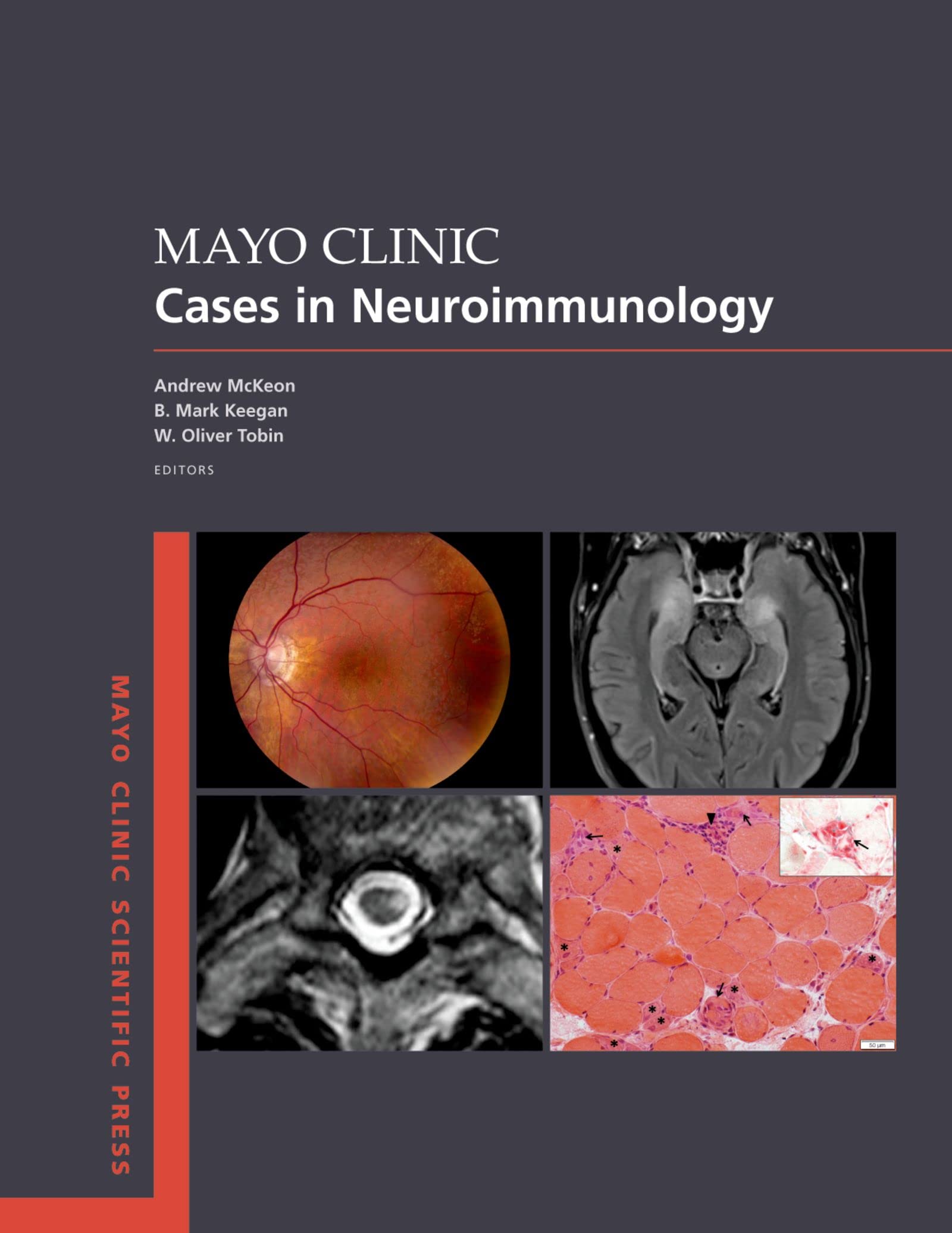 Mayo Clinic Cases in Neuroimmunology (Mayo Clinic Scientific Press) (English Edition)