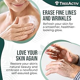 TreeActiv Crepey Skin Repair Cream, 8 oz, Firming Formula with Hyaluronic Acid & Shea Butter to Deeply Moisturize and Tighten Dry, Wrinkly Crepe Skin, 500+ Uses