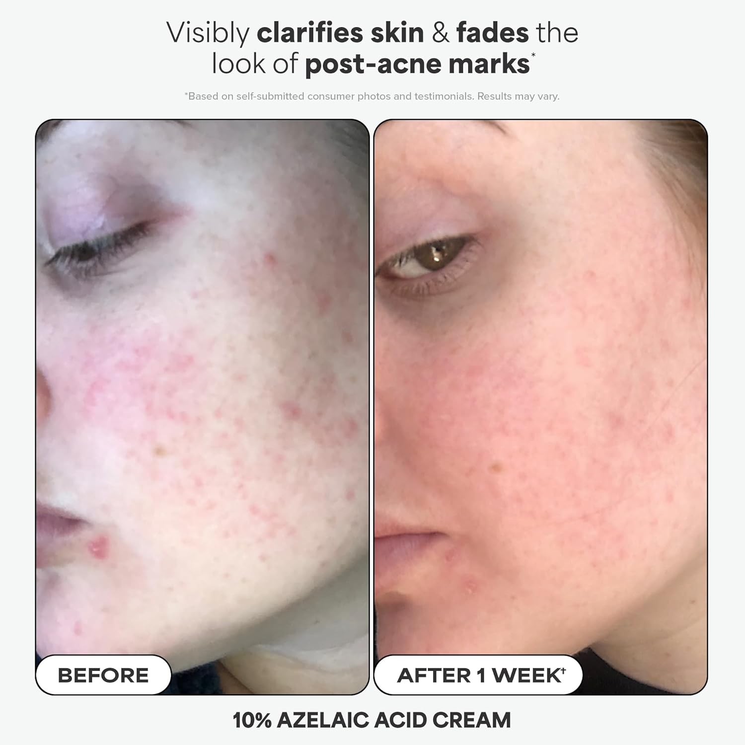 Paula's Choice Favorites Mini Kit, 4 Piece Set Includes 2% BHA Exfoliant, 1% Retinol Treatment, 10% Azelaic Acid Booster, Youth Extending SPF 50 Moisturizer, Travel Skin Care Set for Glowing Skin - Image 3