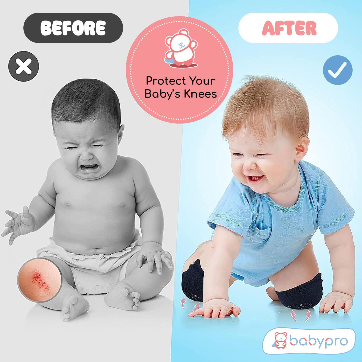 BabyPro Baby Knee Guard-Set of 2, Multicolour Knee Pad for Toddler Crawling 2