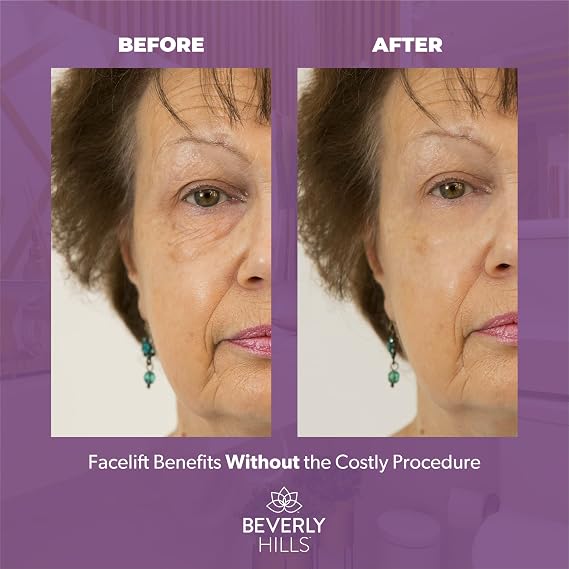 Beverly Hills V-lift Instant Eye Lift & Instant Facelift Anti Aging Eye Serum Treatment Bundle with Discount - Serum Treatment for Dark Circles, Wrinkles & Under Eyebags for Women & Men