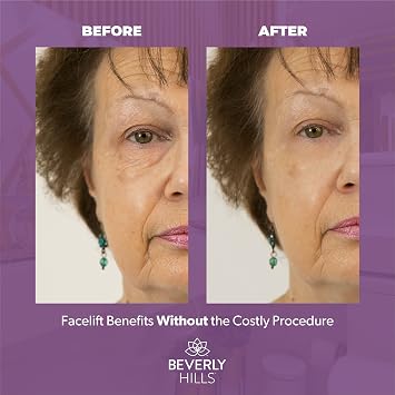 Beverly Hills V-lift Instant Eye Lift & Instant Facelift Anti Aging Eye Serum Treatment Bundle with Discount - Serum Treatment for Dark Circles, Wrinkles & Under Eyebags for Women & Men