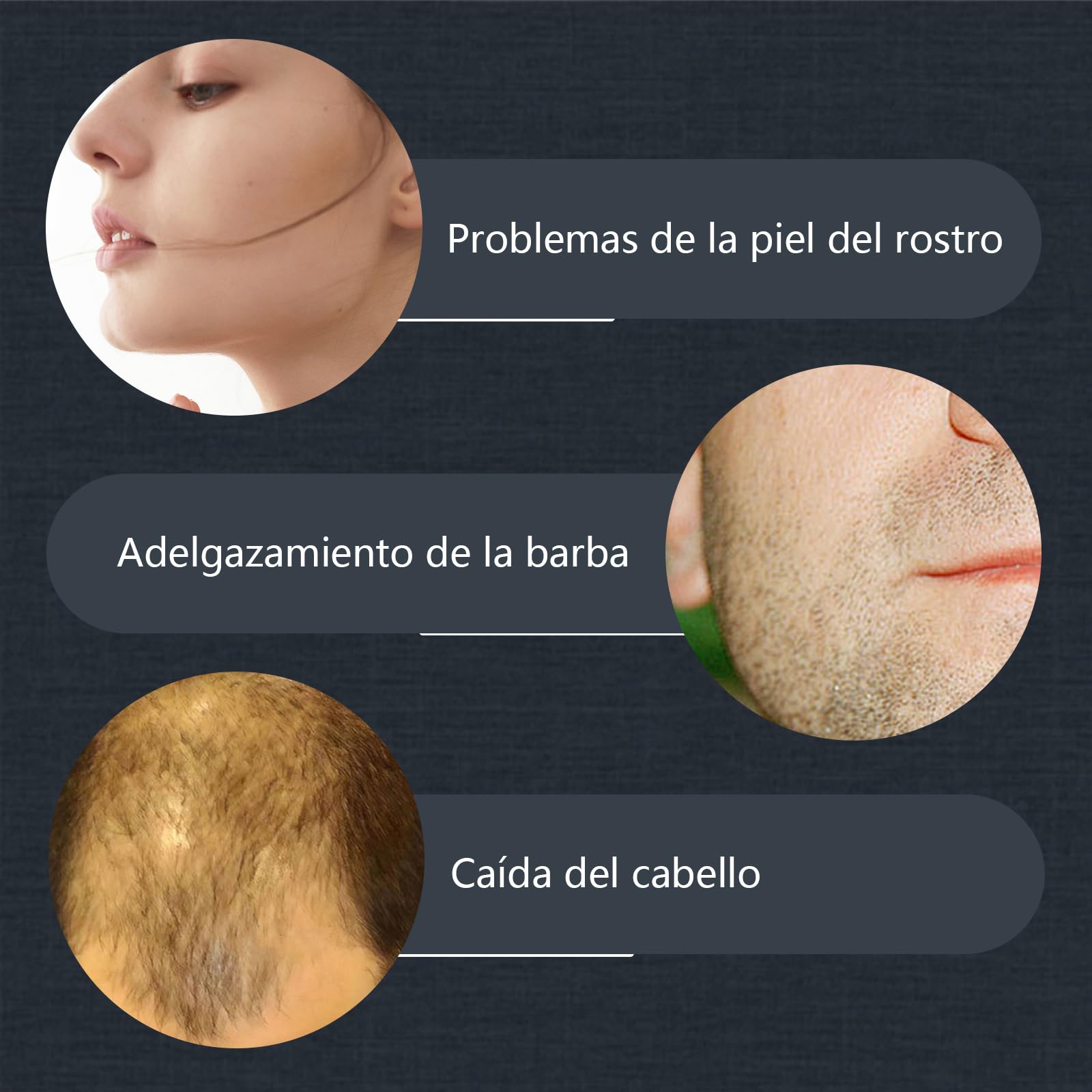 Dr.roller Derma Roller Cabello 0.5mm, Derma Roller para el Crecimiento Antiedad de la Barba y el Cabello, Microneedling para el cuero cabelludo facial — view 4