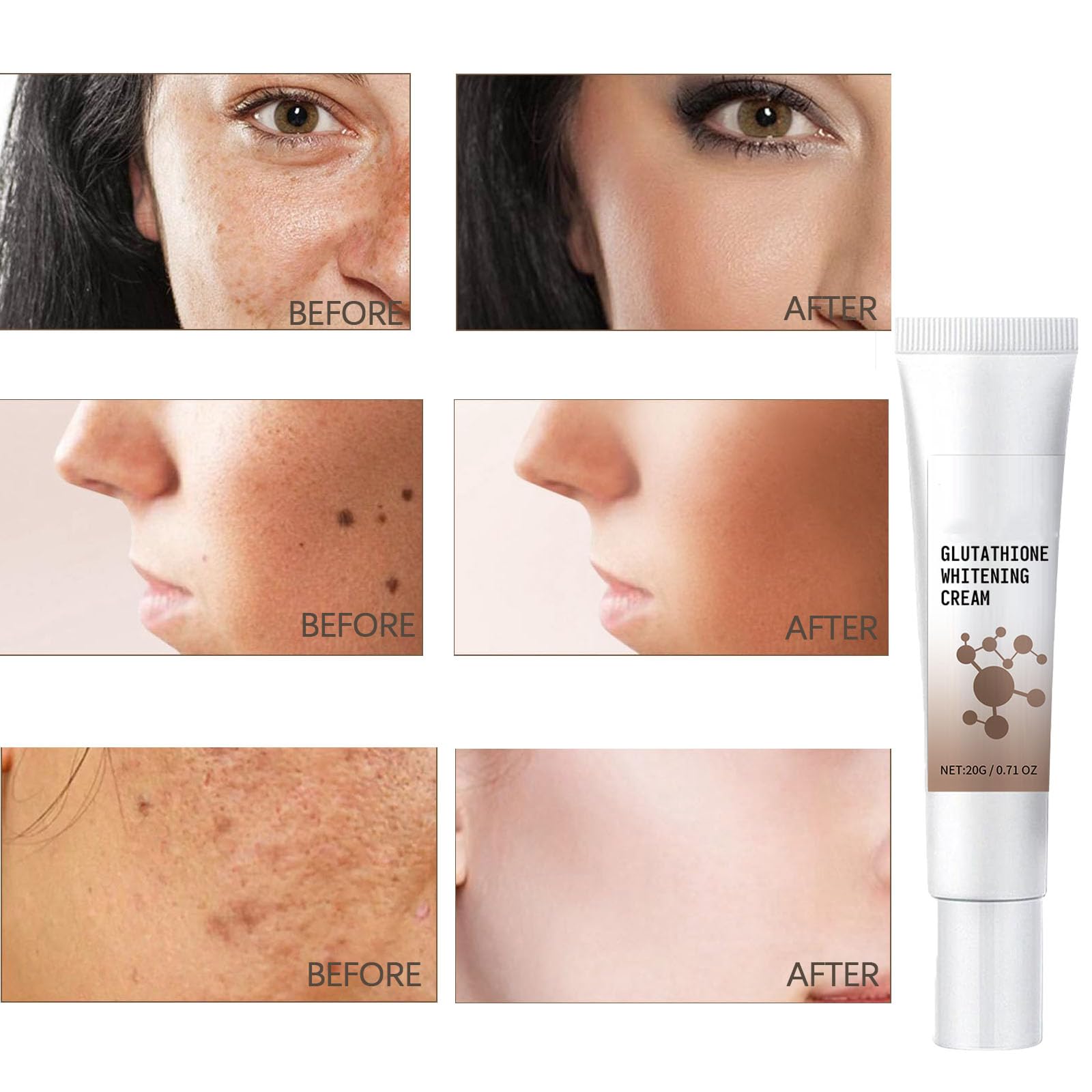 arbutin kojic acid phytic acid glutathione glucosamine onion Frontiers
