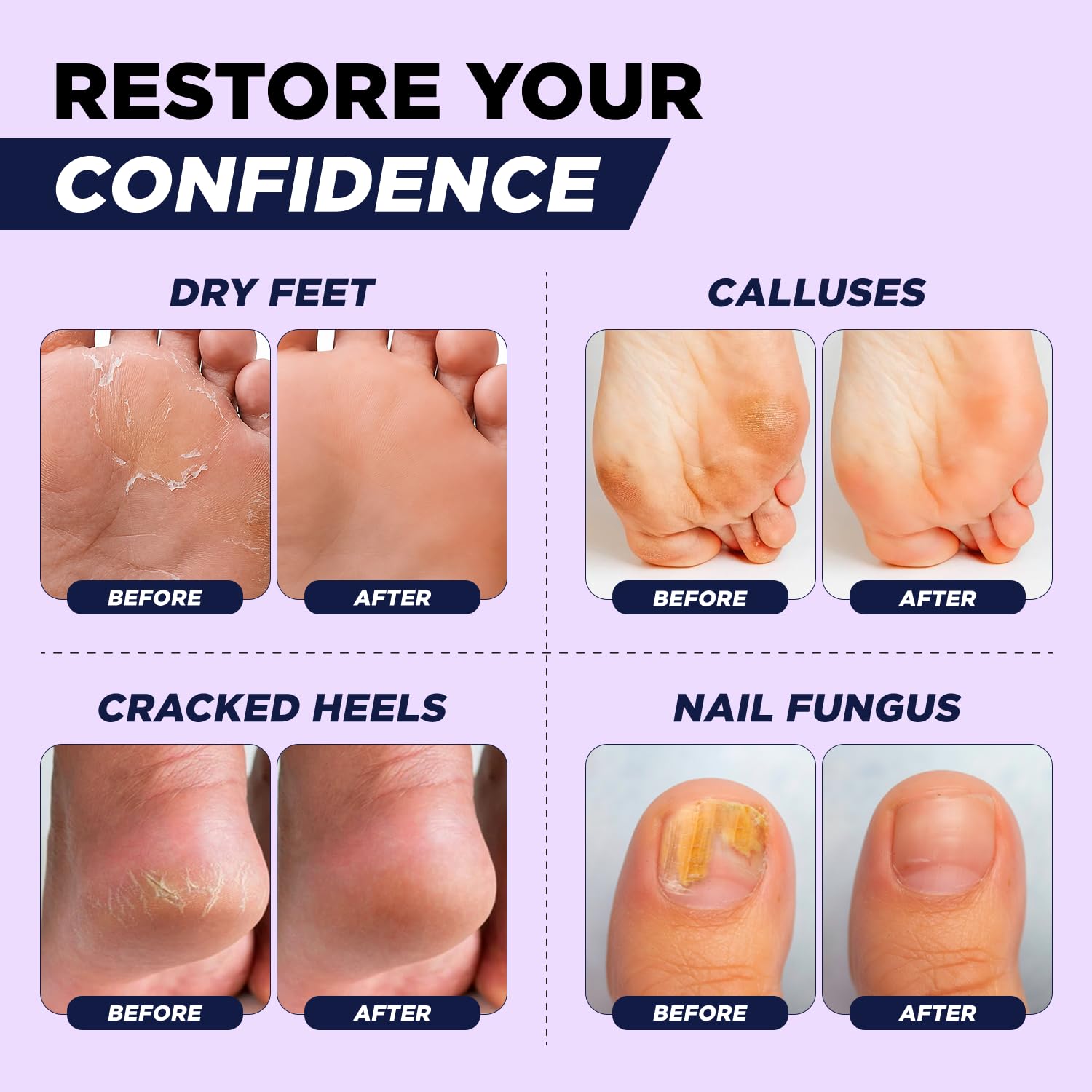 Soothing Lavender Foot Soak with Epsom Salt - Best Toenail Treatment & Softens Calluses - Soothes Sore & Tired Feet, Foot Odor Scent, Spa Pedicure - Made in USA 16 oz