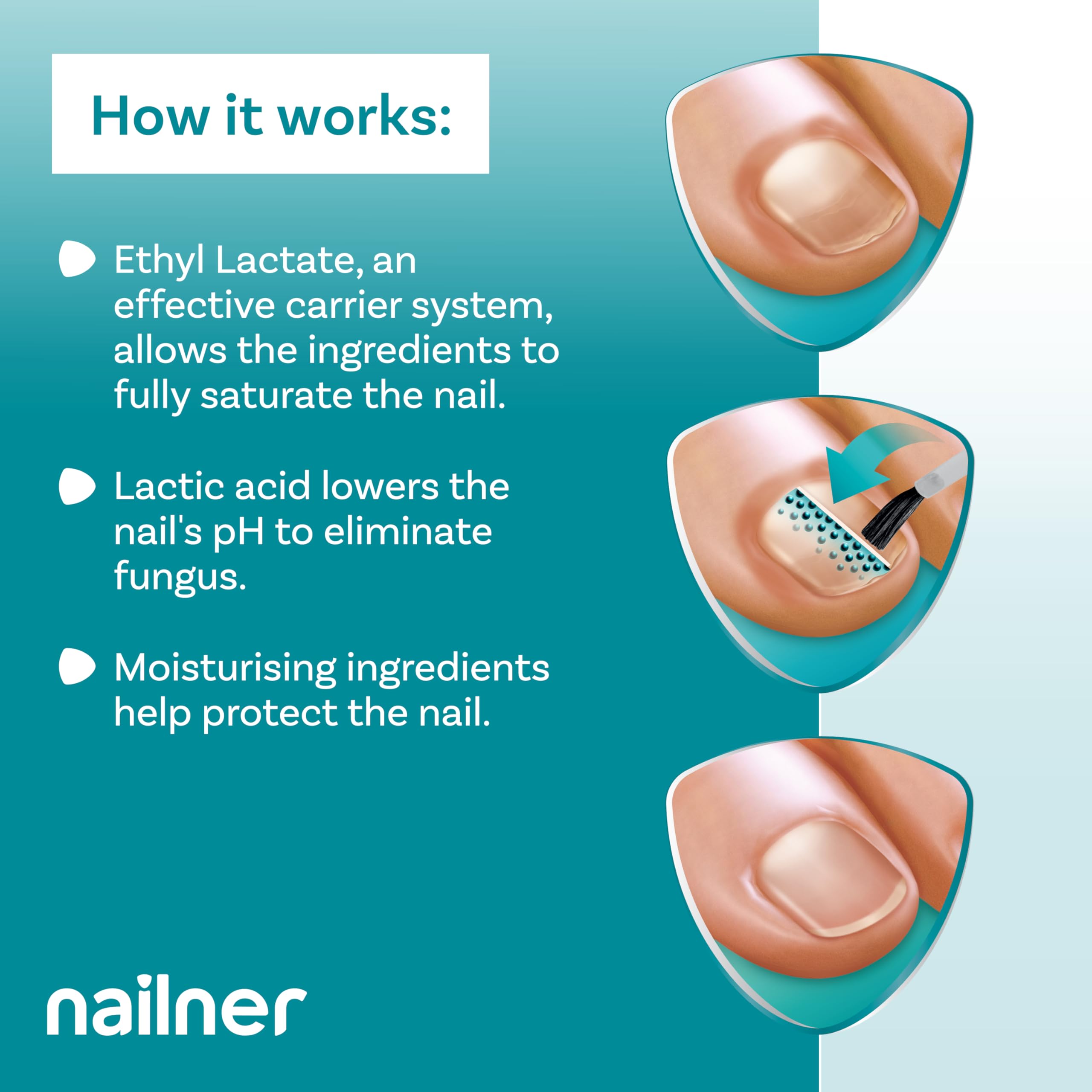 Nailner 2-in-1 Fungal Nail Treatment Brush 14 ml, Treat - Image 4