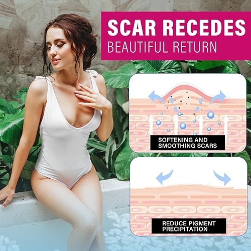 Miniatura 3 de Hojas de silicona para cicatrices, 8 piezas de grado médico y cinta de silicona reutilizable para cicatrices quirúrgicas