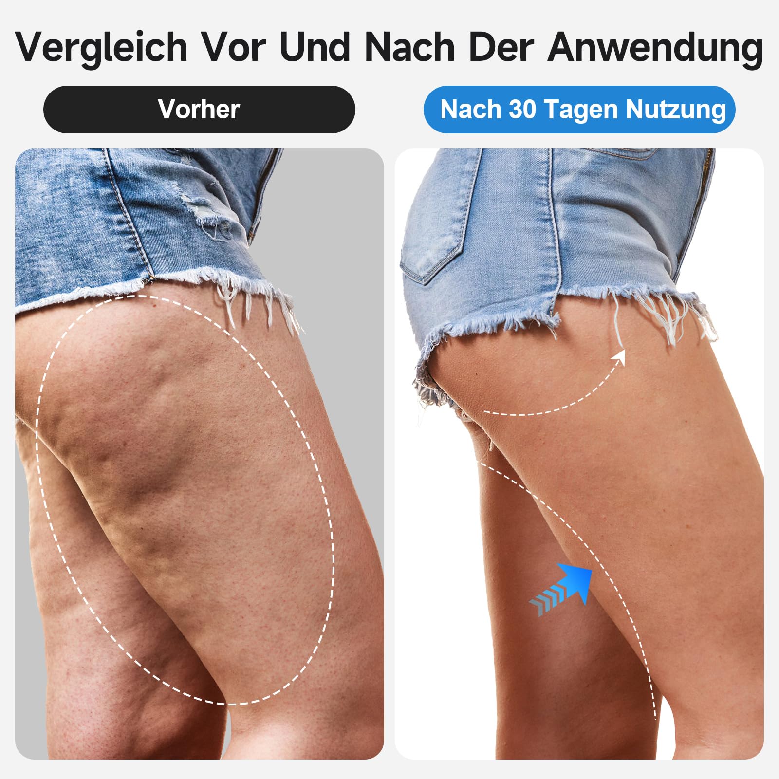 Schröpfgerät Elektrisch 3 in 1 Cellulite Massagegerät