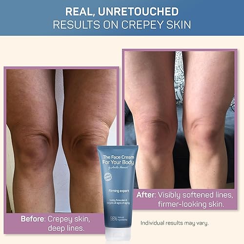 Miniatura 4 de Crepe Firming Advanced Cream - Cuidado de la piel europeo de alta tecnología - Ácido hialurónico en el espectro molecular de 50-3000 kDa -