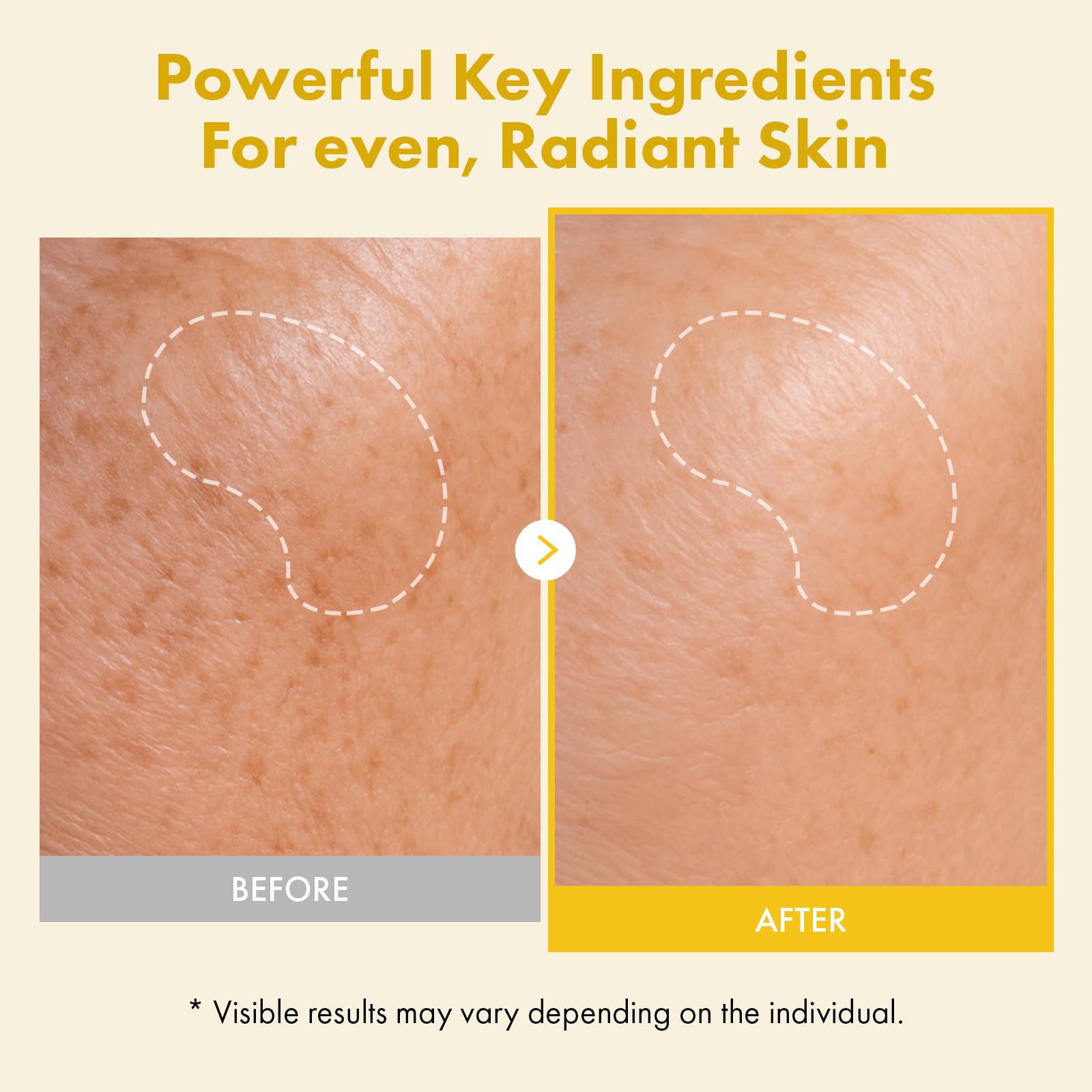 TOSOWOONG Real Kwas Kojowy Kurkuma, Maska Peel-Off na Równy Koloryt | Witaminą C, Glutation, Przebarwienia, Elastyczność, Nawilżenie, Glass Skin, Każdy Rodzaj Cery, K-Beauty, 50 ml