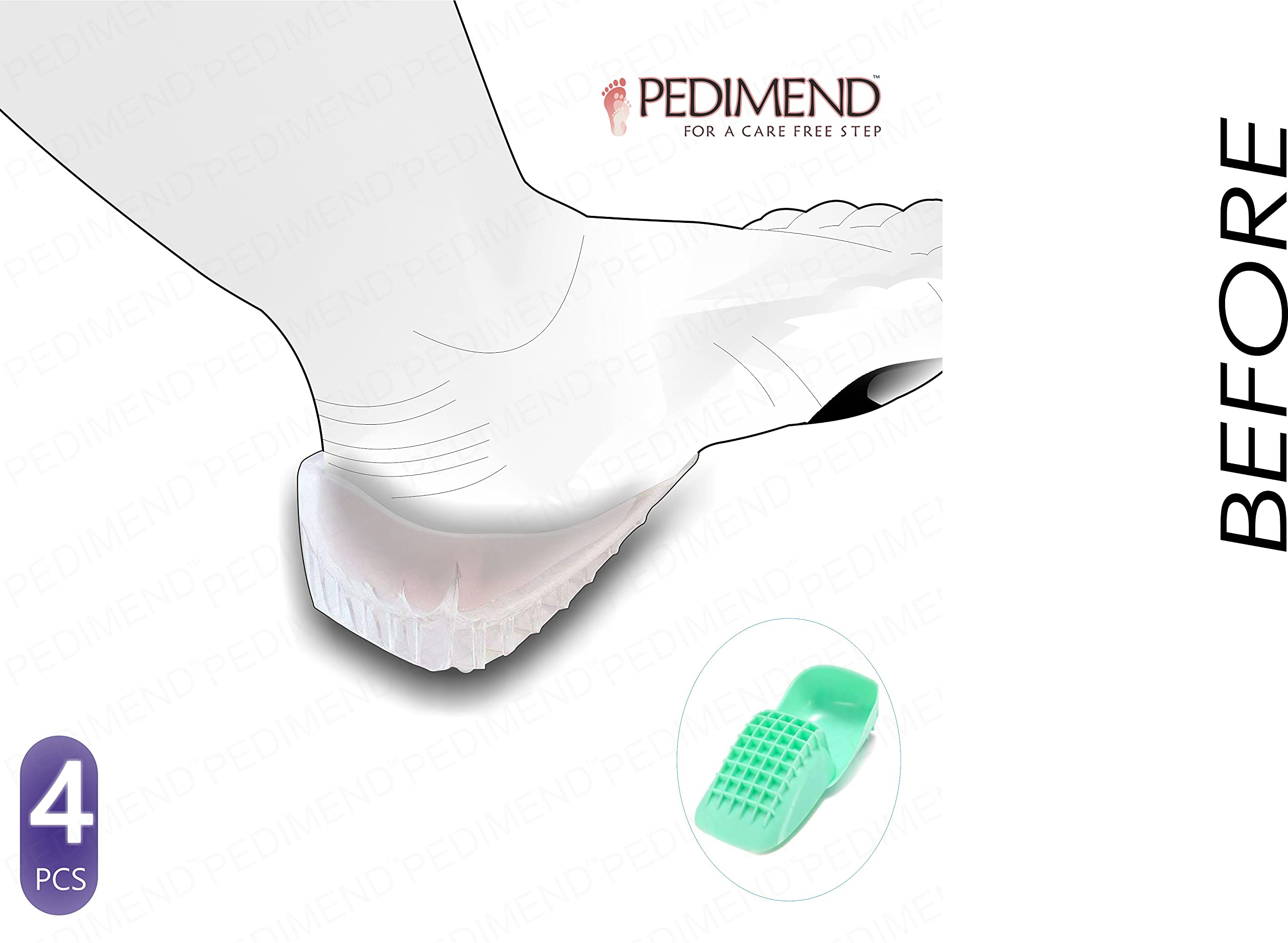 PedimendTM, 2 paia di solette per fascite plantare, doppio cuscino, resistenti e confortevoli, in gel, per tallone posteriore, tendinite tibiale e sport, sollievo dal dolore di Achille, supporto
