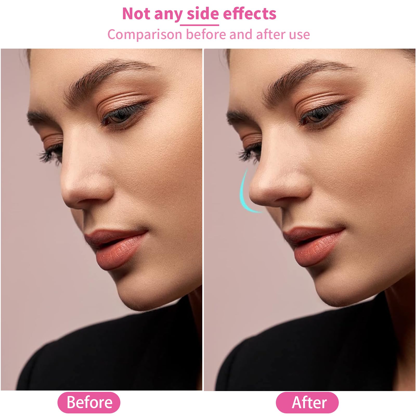 1 ensemble de pinces à nez en silicone, pince-nez pour pont nasal, pince magique pour rehausser le nez sans douleur, masseur de nez