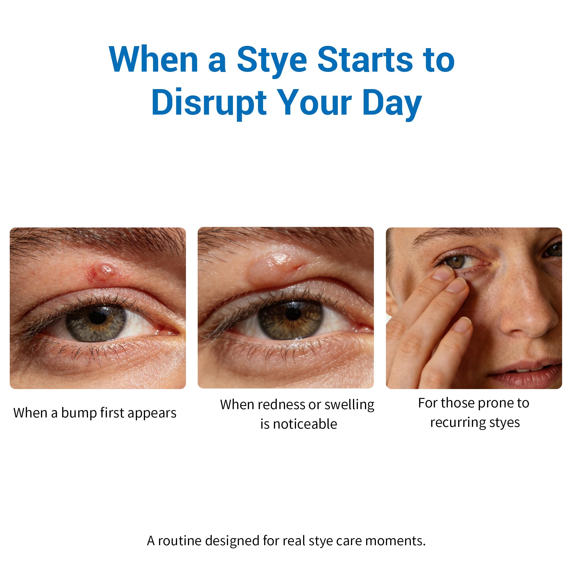 Stye Eye Relief Serum and Steam Eye Mask Kit