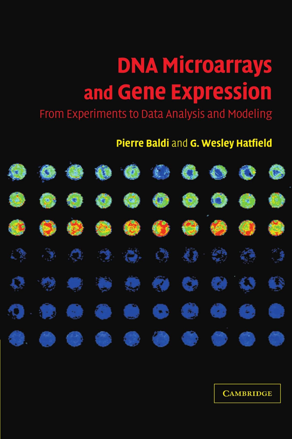 【洋書】DNA MIcroarrays and Gene Expression Amazon | DNA Microarrays and Gene Expression: From Experiments to