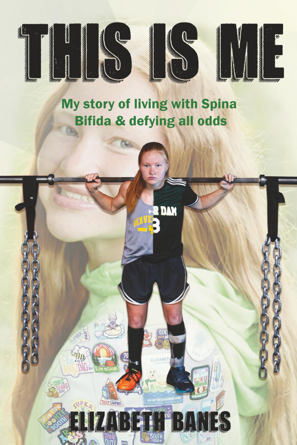 This Is Me: My story of living with Spina Bifida & defying all odds