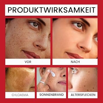 Pigment Spot Remover Cream Face Whitening Cream Against Dark Spots Dark Spot Remover for the Body Dark Spot Correction Cream for Armpits Inner Thigh and Intimate Areas (1)