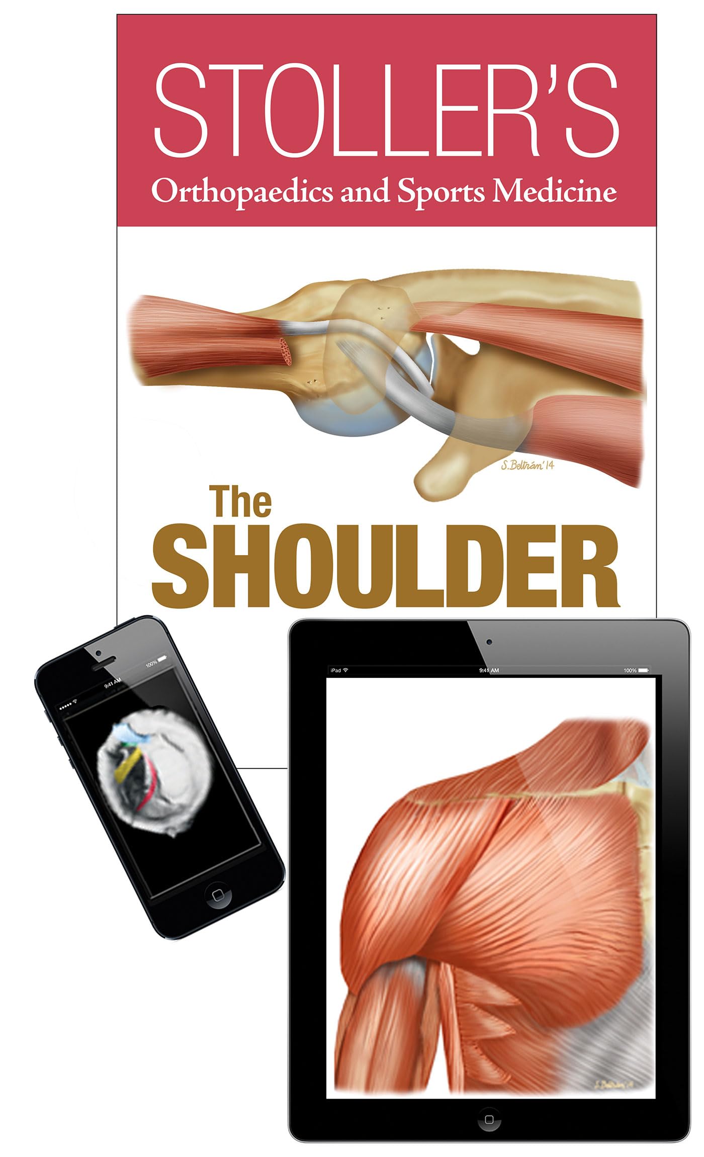 Stoller's Orthopaedics and Sports Medicine: The Shoulder Pack... - 9781496313331