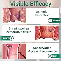Vista 6 de LMNOOP® Ungüento para tratamiento de hemorroides, tratamiento de máxima fuerza y alivio rápido para el dolor, picazón, ardor, hinchazón, fisura