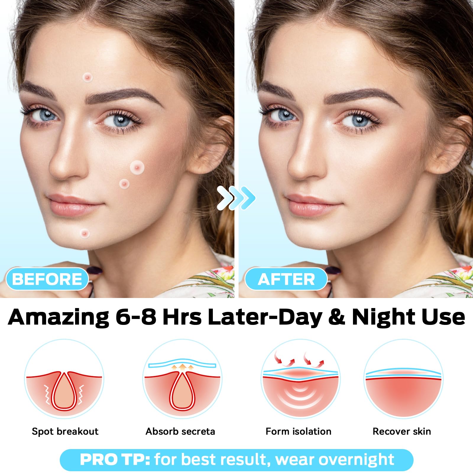 Pimple Patches, 360 Count Invisible Spot Patches, Absorbing Hydrocolloid Patch , Skin Care, Facial Stickers, Cute Face Patches for Face - Image 4