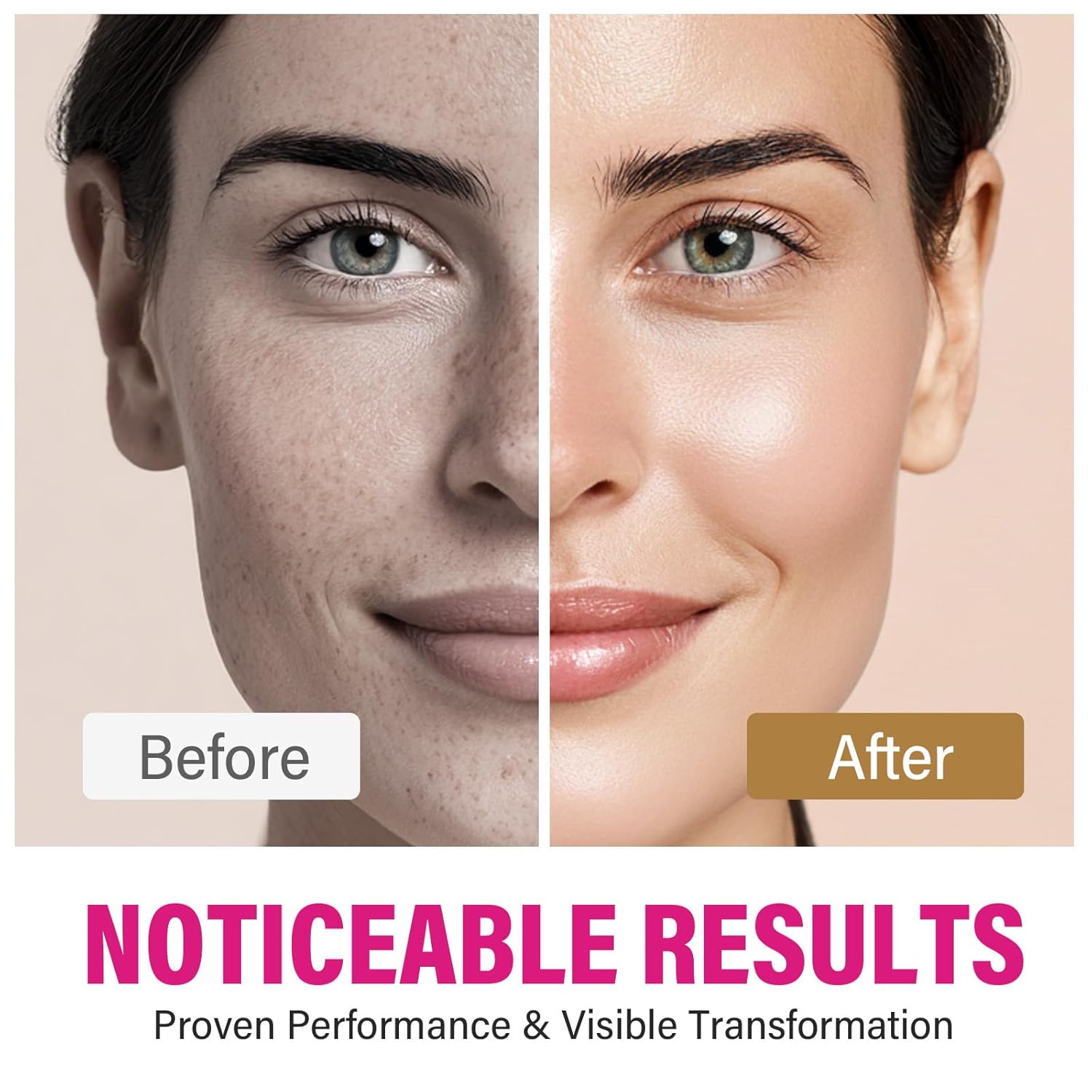 Arbutin 8% + Tranexamîc Acid 5% Cream 2 IN 1, 80,000ppm Arbutin, 50,000ppm TXA, Facial Cream for Dark Spots, Freckle, Blemishes & Pigmentation, Safe for Sensitive Skin, 2 fl.oz - Image 3