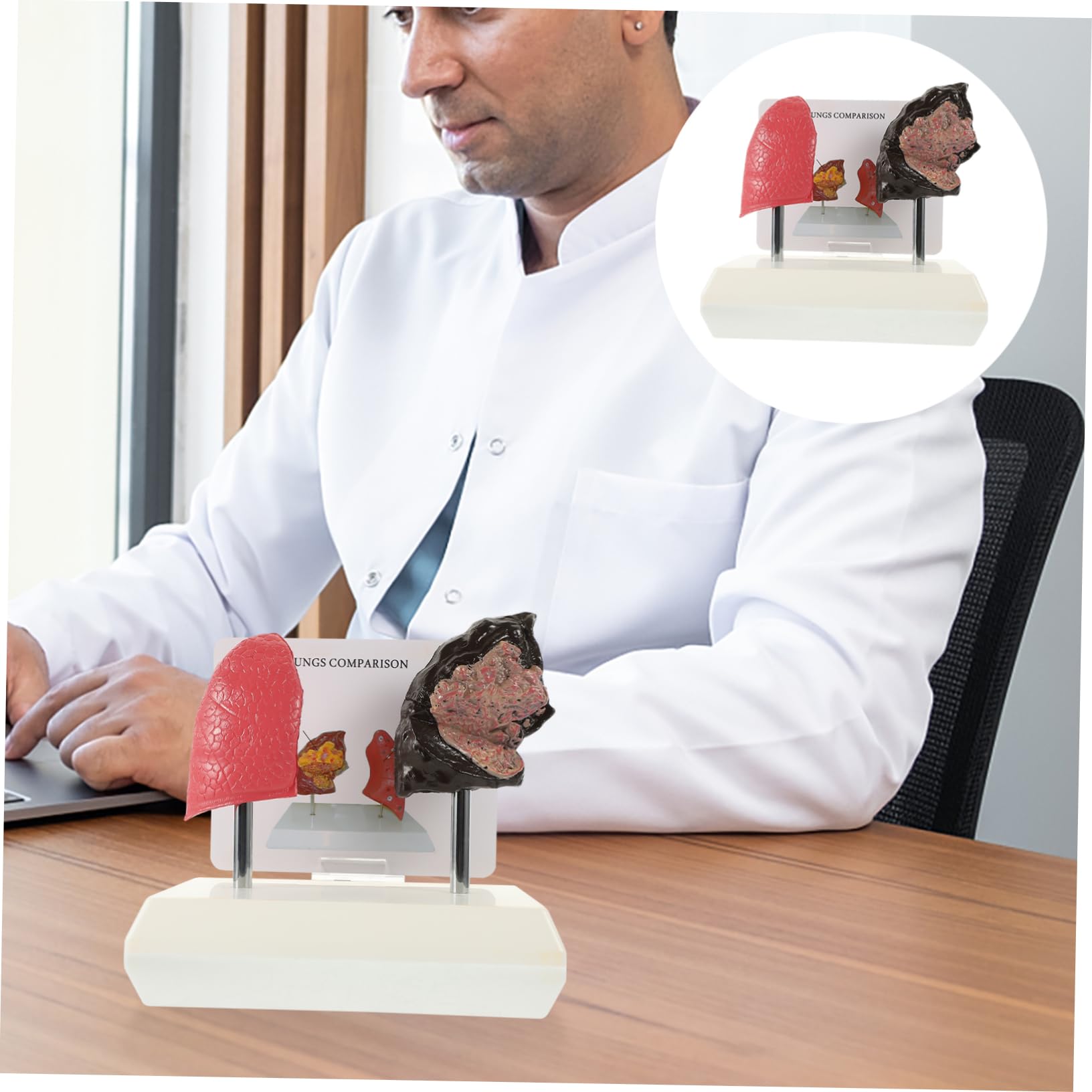 SOLUSTRE Educational Lung Model Human Lung Smoking Models Normal Vs. Pathological Lung