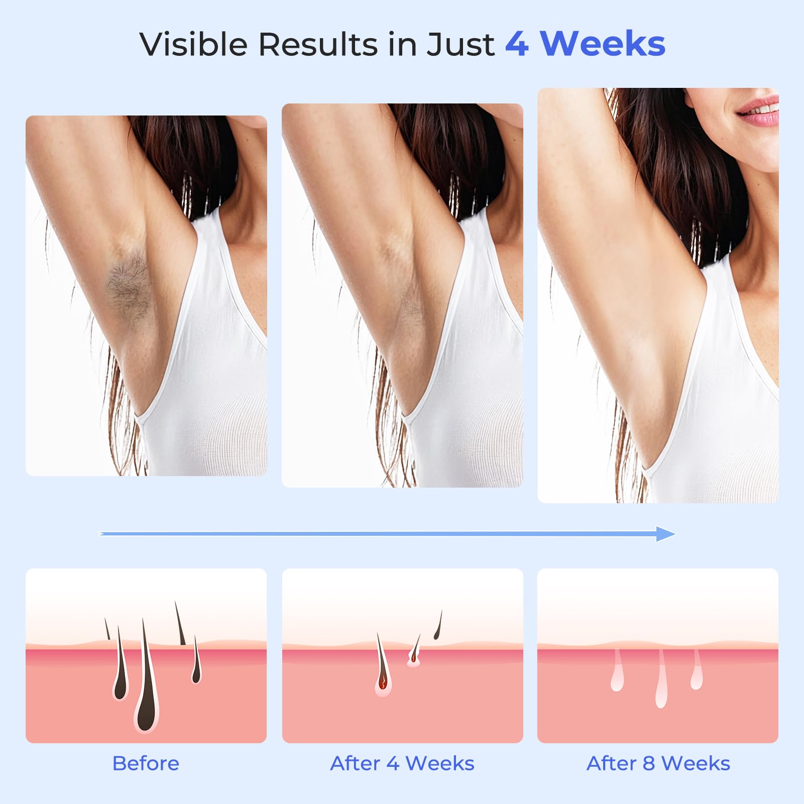 21J Depiladora Laser Indolora con Función De Refrigeración, Depiladora Luz Pulsada 9 Niveles de Energía, Maquina Laser Depilacion Casa para Rostro, Bikini y Cuerpo, Blanco