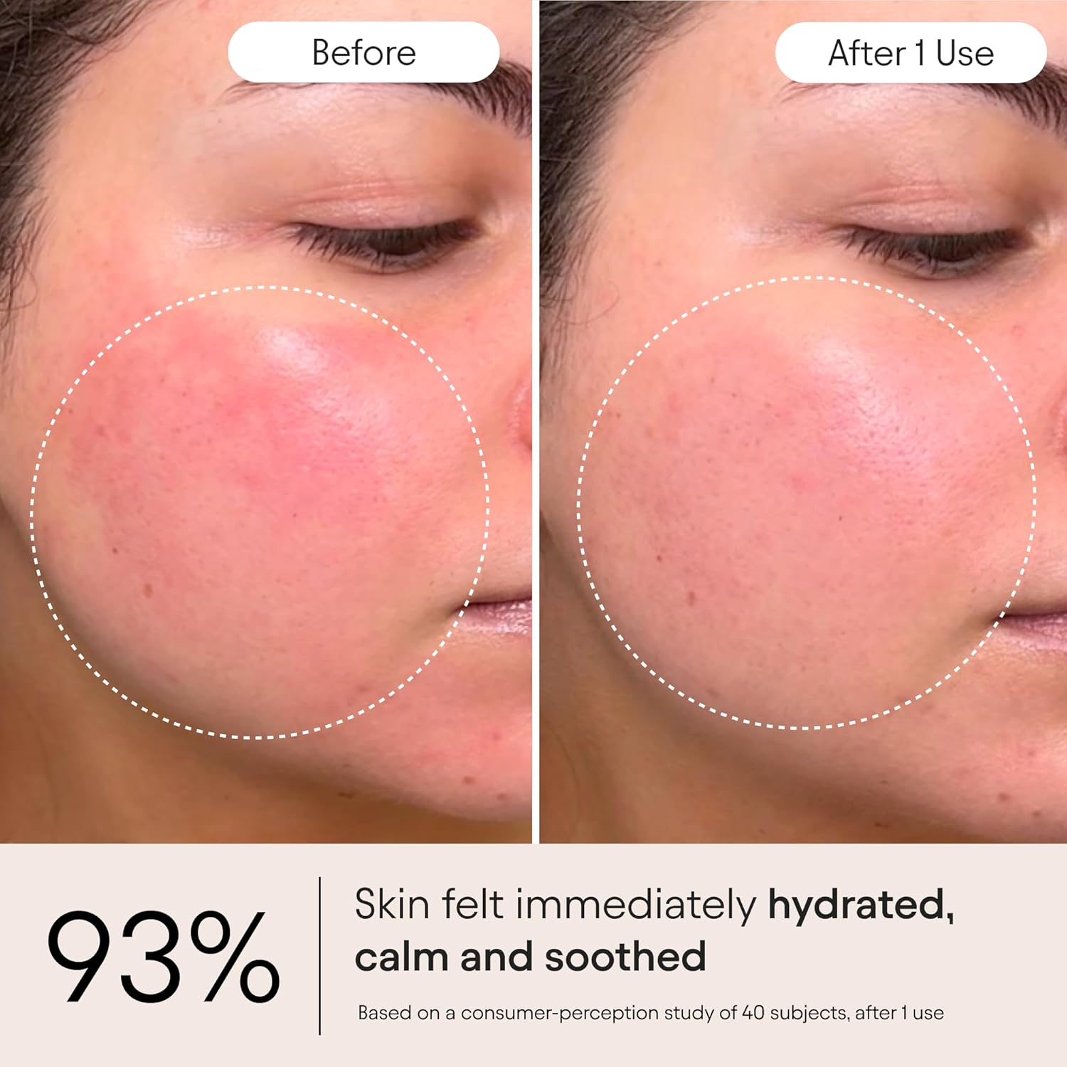 Alpyn Super Peptide & Ghostberry Moisturizer for Eczema, Barrier & Wrinkle Repair | Calm & Soothe Against Redness & Irritation | 1.7 oz / 50 ml - Image 4